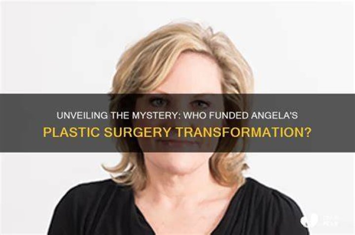 Who paid for Angela's plastic surgery?