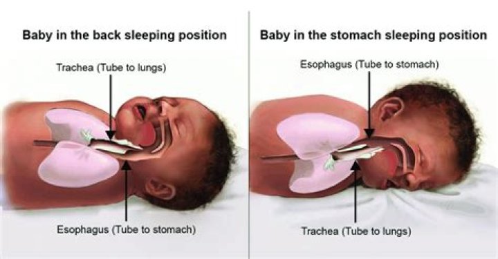 Why are babies supposed to sleep on their backs?