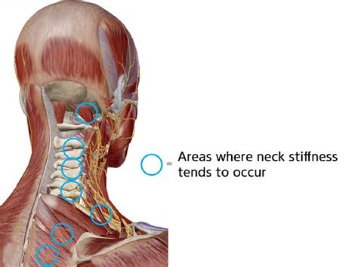 Why are my neck muscles so tight?