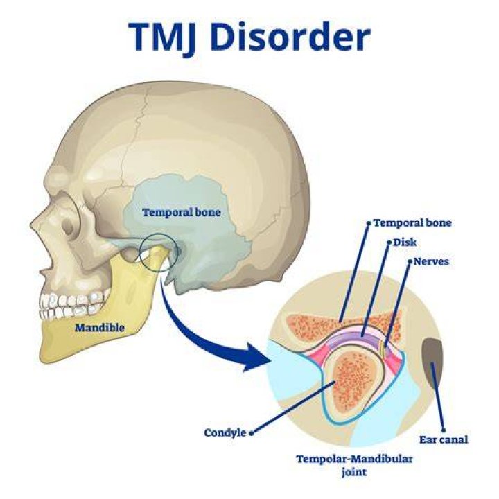 Why does TMJ make my ear hurt?