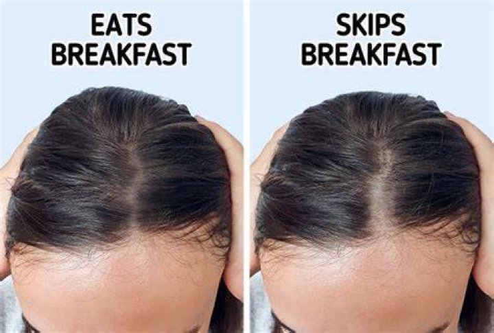 Why is my hair so soft and thin?