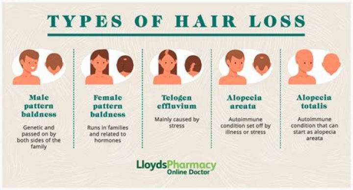 Why is my hair suddenly flat?