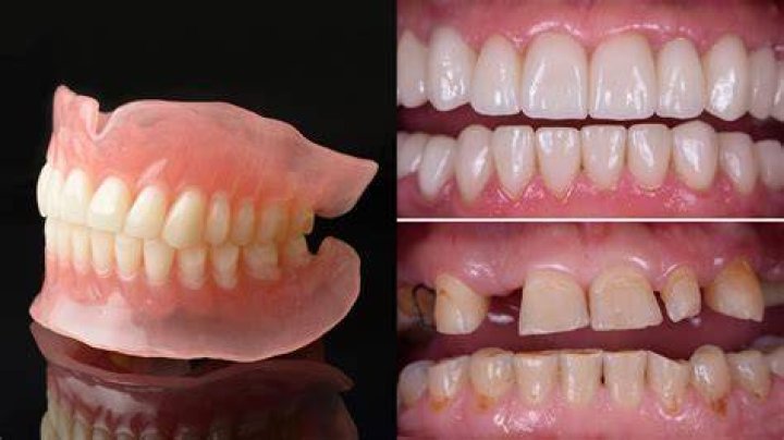 Will people be able to tell I have dentures?